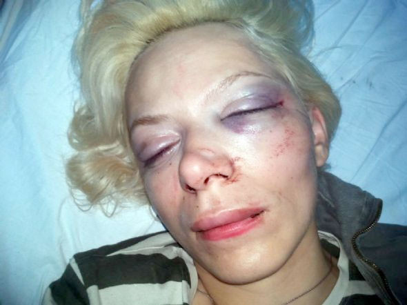 Dayakçı kocaya hapis yolu - Resim: 3