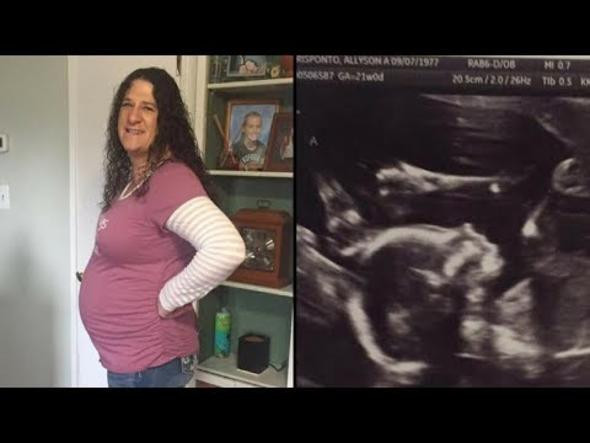 Dünyayı hayrete düşürdü tam 4 kez düşük yaptı ve... - Resim: 3