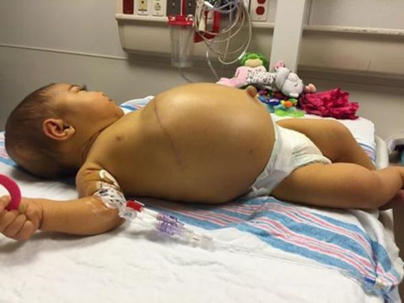 Bebeğin karnı her geçen gün şişiyordu öğrendikleri gerçekle şok oldular - Resim: 3