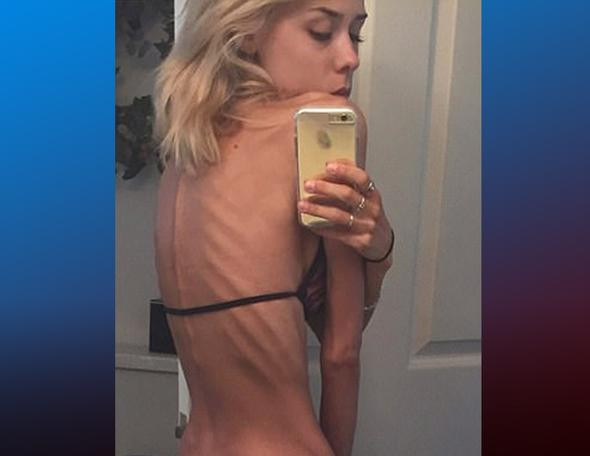 İki sene önce ölmek üzereydi şimdi ise... Son haline bakın - Resim: 1