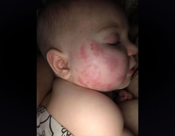 Bebeğini kreşe bıraktı aldığında ise bu halde buldu! - Resim: 3