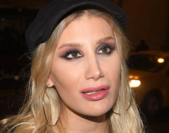 Bana yaklaşmayın yeni botoks yaptırdım! İşte İrem Derici'nin eski ve yeni hali... - Resim: 3