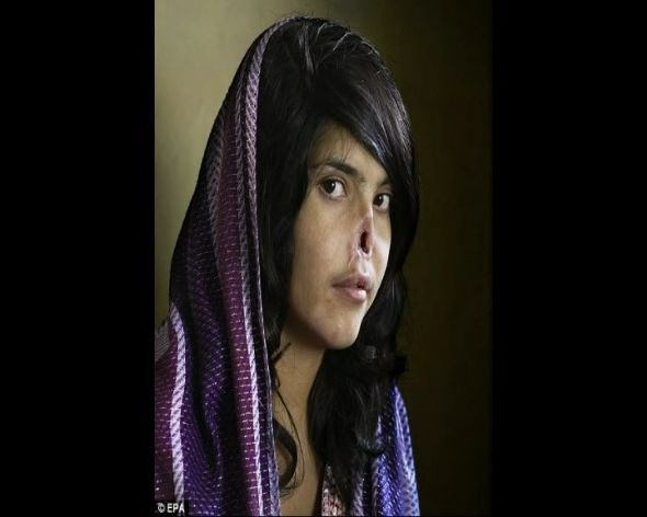 Bu kızı tanıdınız mı? - Resim: 3