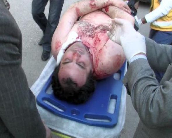 Falçatayla dehşet saçtı! - Resim: 2