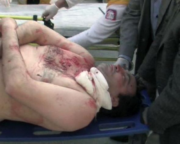 Falçatayla dehşet saçtı! - Resim: 3