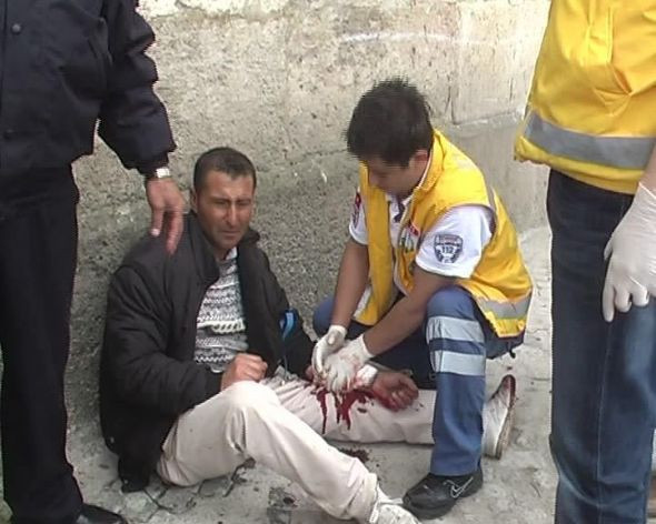 Bunalıma girdi kendini böyle kesti! - Resim: 1