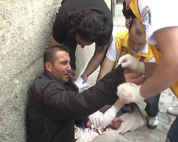 Bunalıma girdi kendini böyle kesti! - Resim: 2