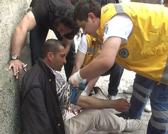 Bunalıma girdi kendini böyle kesti! - Resim: 4