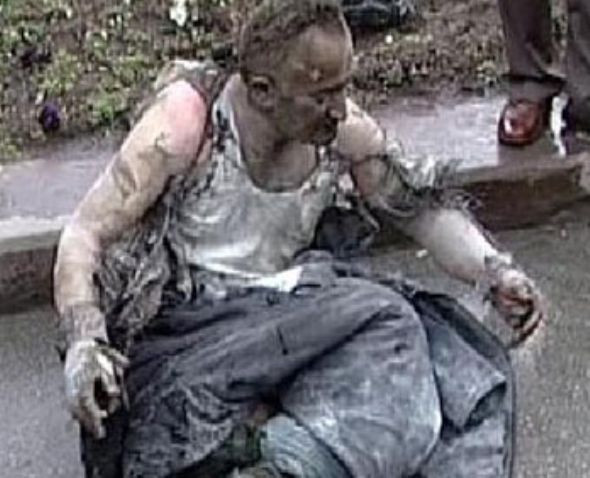 Kızılay Meydanı'nda kendini yaktı! - Resim: 4