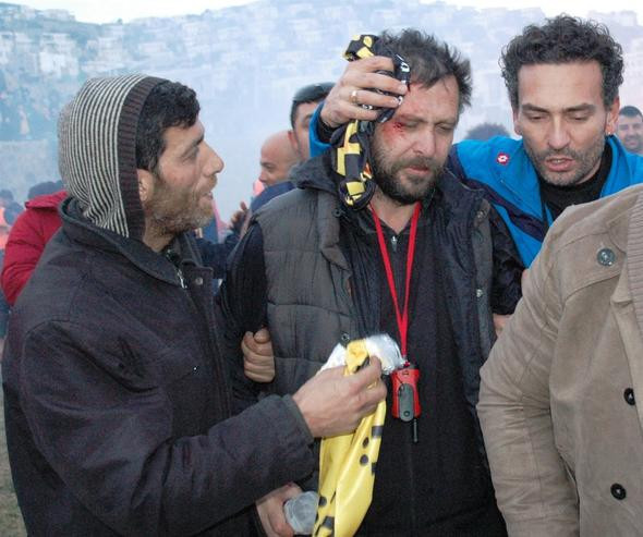 Hayranının fotoğraf isteğini reddedince dayak yedi - Resim: 3