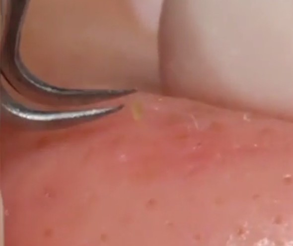 You Tube'da binlerce kez izlendi hiç böylesi yok! - Resim: 3