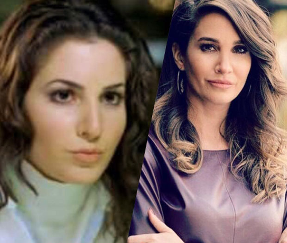 Müge Boz öyle bir estetik yaptırmış ki görenler şaştı kaldı - Resim: 2