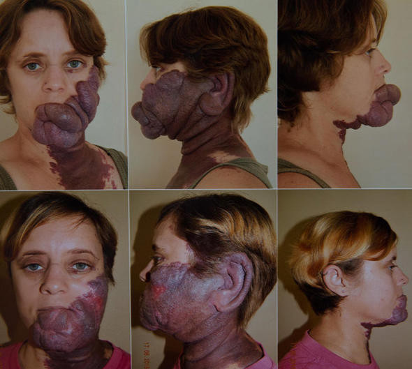 'İnsan yiyici' diye dalga geçiyorlardı! Büyük değişim yaşadı - Resim: 3