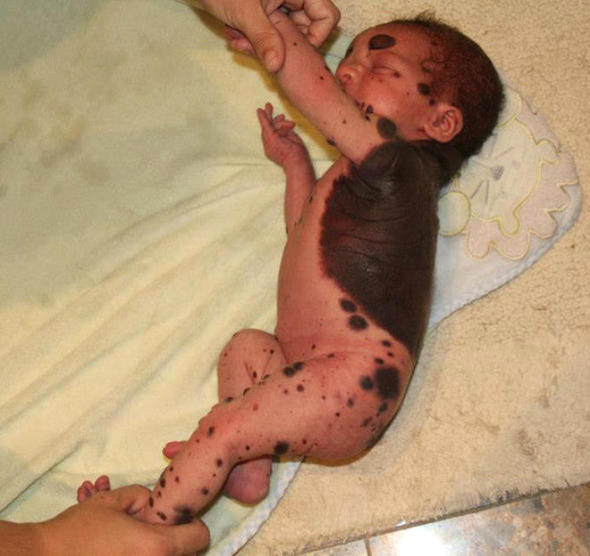 Bu şekilde doğdu! Doktor gerçeği açıkladı herkes şaşırdı - Resim: 1