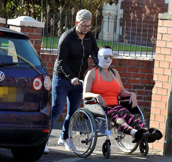 Kaza geçirmedi güzelleşmek istedi! Ünlü isim tanınmaz halde - Resim: 3