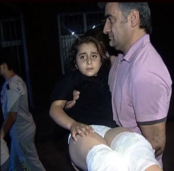 Küçük kızı Pitbullun ağzından aldı - Resim: 3