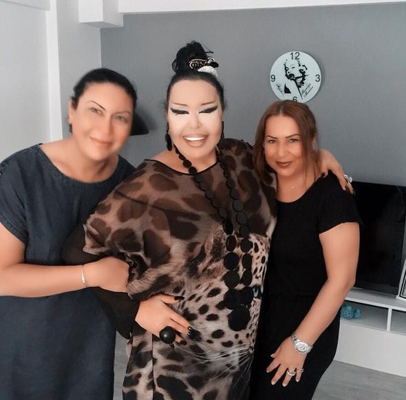 Yok böyle değişim! Bülent Ersoy'a benzemek için 10 ameliyat oldu - Resim: 2