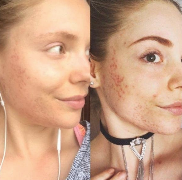 Hayatı kabusa dönmüştü! Keşfettiği besinle yeniden doğdu - Resim: 2