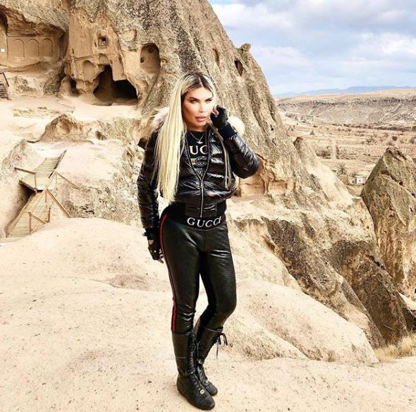 Ken Bebek lakaplı Rodrigo Alves yaptırdığı botokslar sonucu cinsiyet değiştirdi! - Resim: 2