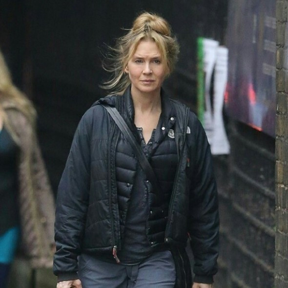 Dudaklara dolgu yaptıran ünlü oyuncunun hali fena - Resim: 2