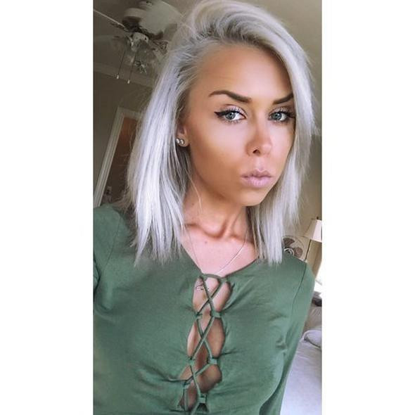 2 yıl önce neredeyse ölüyordu.. Şimdiki haline çok şaşıracaksınız - Resim: 3