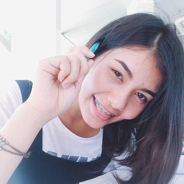 Miss Universe katıldı 6 ay önceki hali şoke etti! - Resim: 2