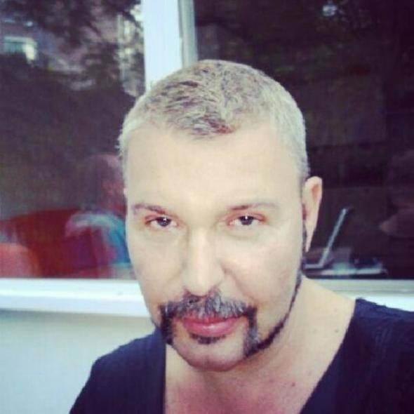 Sana ne oldu Aydın? Görenler tanıyamadı son hali olay - Resim: 3