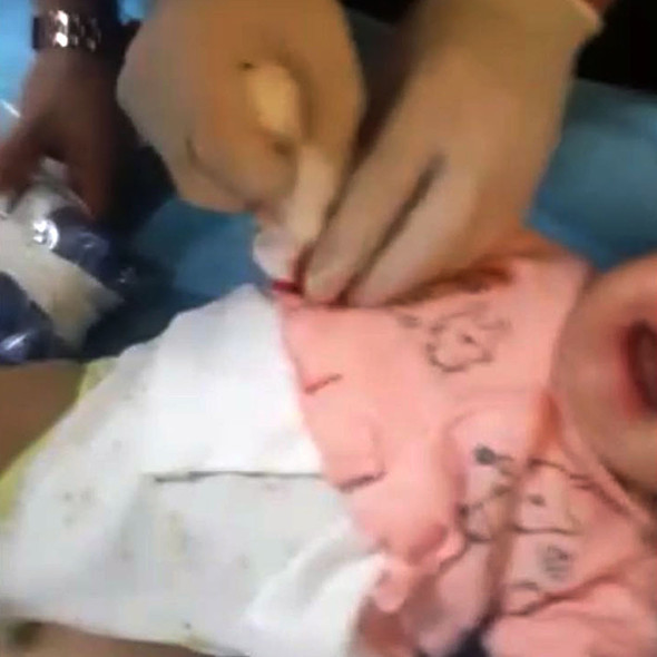 Serumu çıkarmak isterken bebeğin parmağını kesti! - Resim: 2