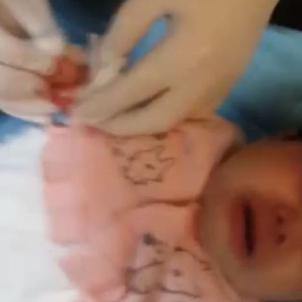 Serumu çıkarmak isterken bebeğin parmağını kesti! - Resim: 4