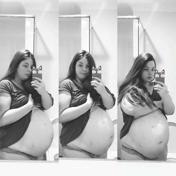 Karnı sürekli büyüyordu! Ultrasona girence şok oldu... - Resim: 1