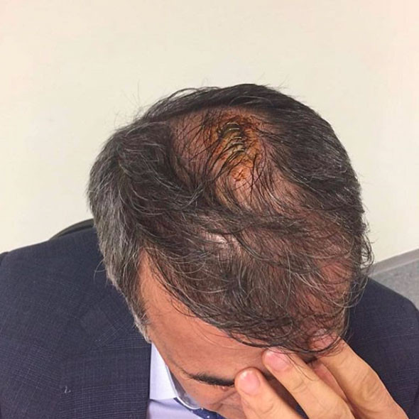 Ahmet Çakar'dan olay derbi tahmini! Fenerbahçe yenilirse... - Resim: 4