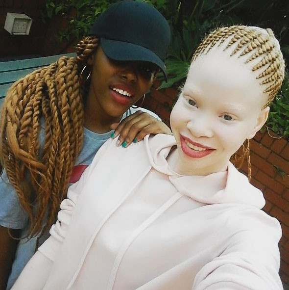 Dış görünüşü korkuttu herkes onunla dalga geçti ama... - Resim: 4