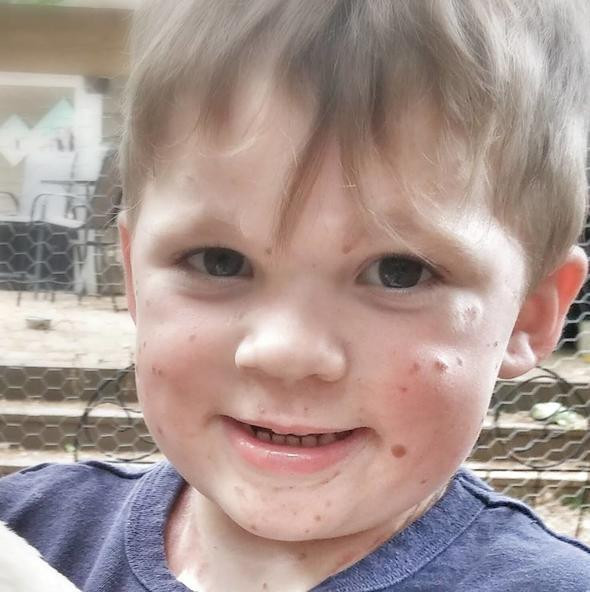 Bu şekilde doğdu! Doktor gerçeği açıkladı herkes şaşırdı - Resim: 4