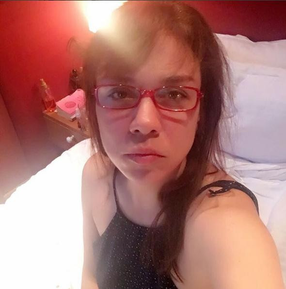 Bu halinden eser kalmadı iğne ipliğe döndü - Resim: 3