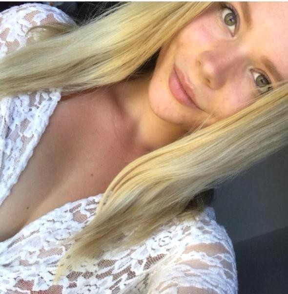 Hayatından tek bir besini çıkardı sivilcelerden kurtuldu - Resim: 2