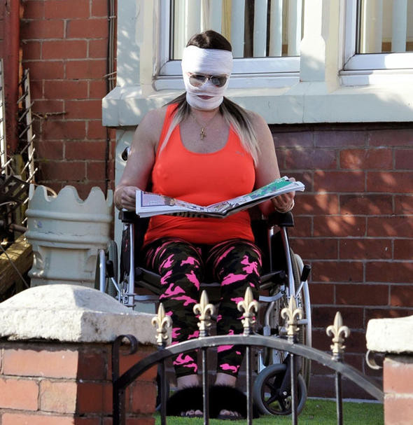 Kaza geçirmedi güzelleşmek istedi! Ünlü isim tanınmaz halde - Resim: 2