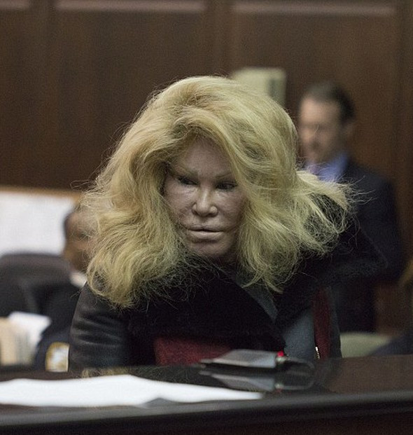 Kedi kadın sevgilisinin yüzünü parçaladı - Resim: 3