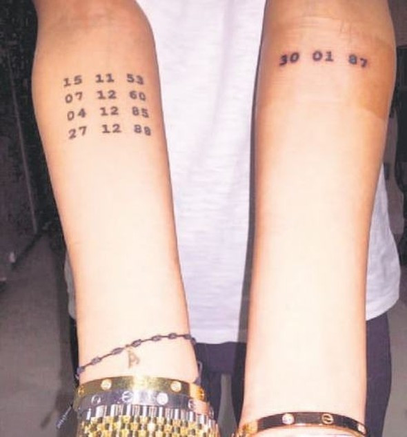 Arda Turan'ın dövmesini sildiriyor - Resim: 2