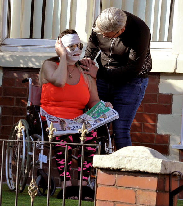 Kaza geçirmedi güzelleşmek istedi! Ünlü isim tanınmaz halde - Resim: 4