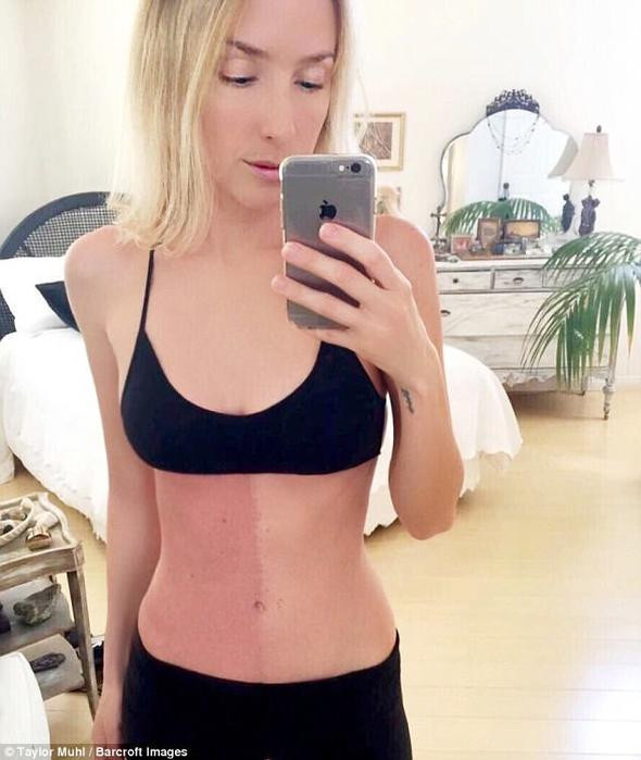 Yıllarca leke sanıyordu! Gerçeği öğrendi hayatının şokunu yaşadı - Resim: 1