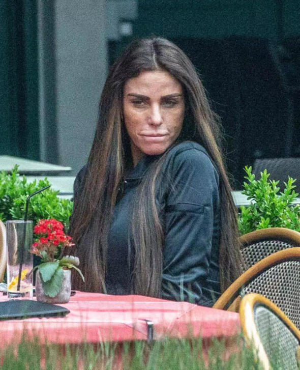 Estetik bağımlısı şarkıcı tanınmaz halde! Son hali içler acısı - Resim: 1