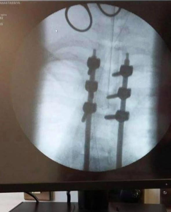 Darbe üstüne darbe! Kız arkadaşını felç bırakıp onu aldattı - Resim: 4