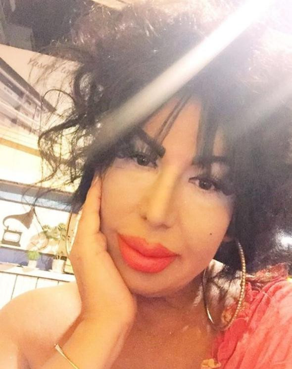 Yok böyle değişim! Bülent Ersoy'a benzemek için 10 ameliyat oldu - Resim: 4