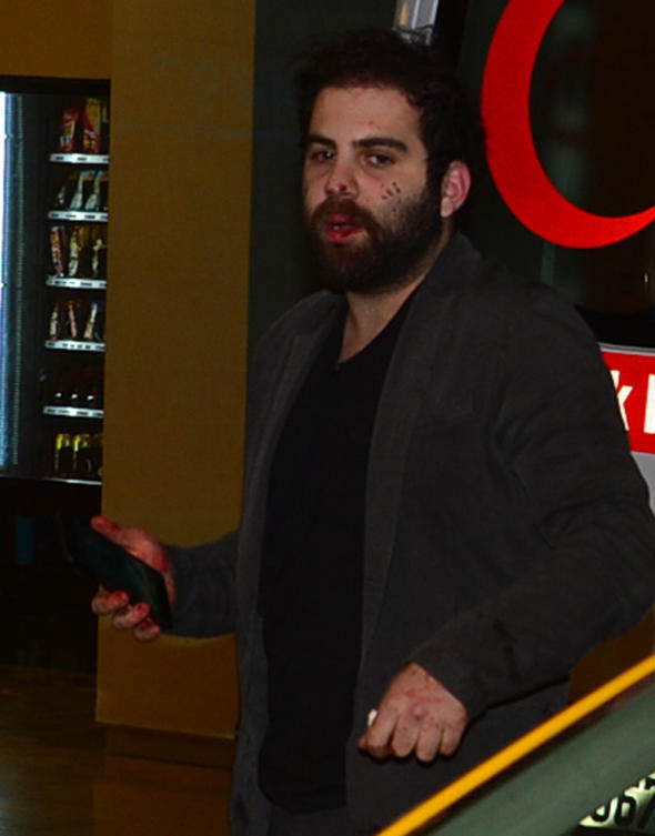 Oğuz Çetin’in oğlunu dövdüler! Kan revan içinde kaldı - Resim: 1