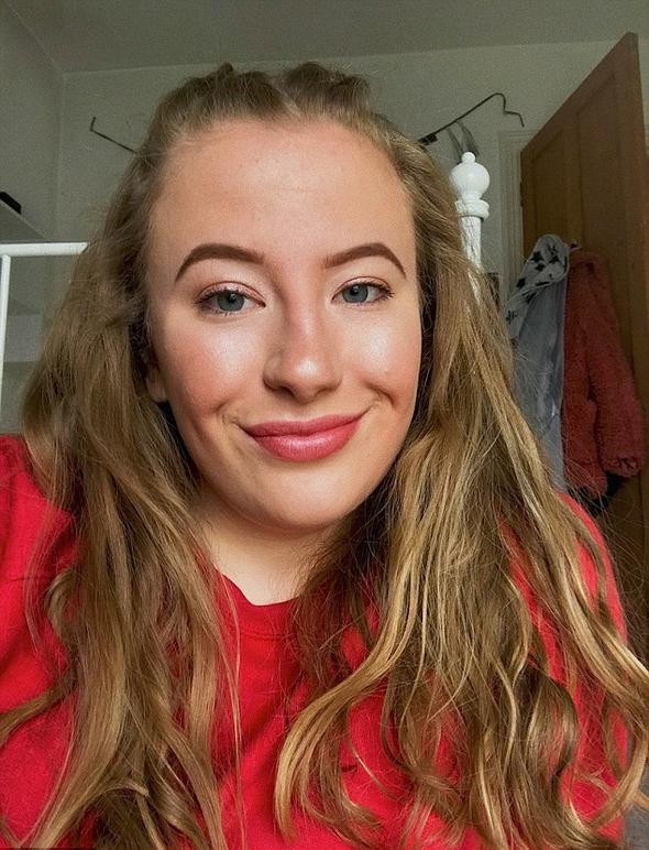 İşte gerçek Uyuyan Güzel! Bir uyuyor bir daha uyanmıyor - Resim: 2