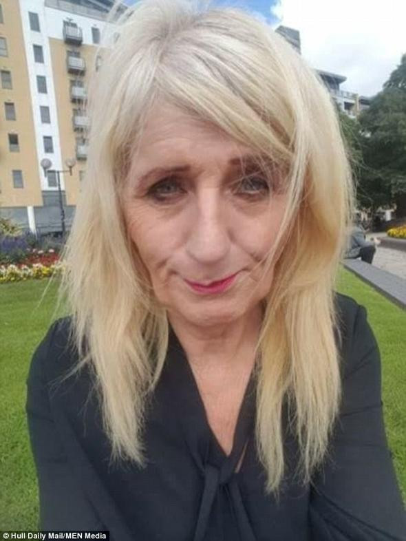 Bu halinden eser kalmadı! Piyangodan parayı buldu tamamen değişti - Resim: 2