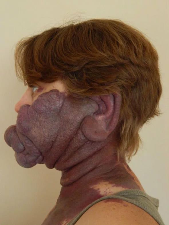 'İnsan yiyici' diye dalga geçiyorlardı! Büyük değişim yaşadı - Resim: 2