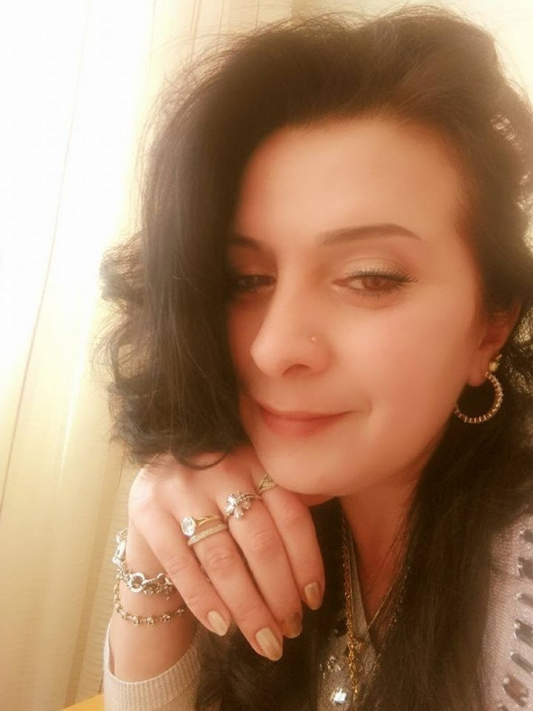 Dişlerini beyazlatmak istedi ancak 32 dişinden oldu şimdi ise... - Resim: 4