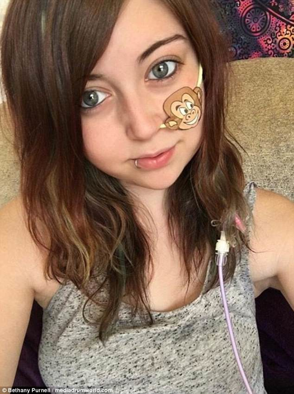 17 yaşında bağırsaklarını aldırdı: Yeni hayatına böyle başladı! - Resim: 4