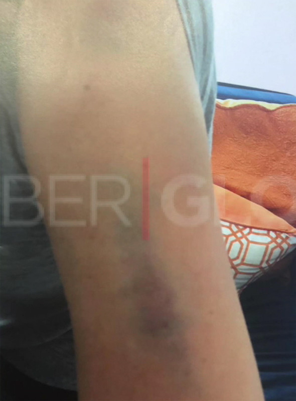 Korkunç detaylar: Sıla'nın darp raporu ortaya çıktı! - Resim: 4